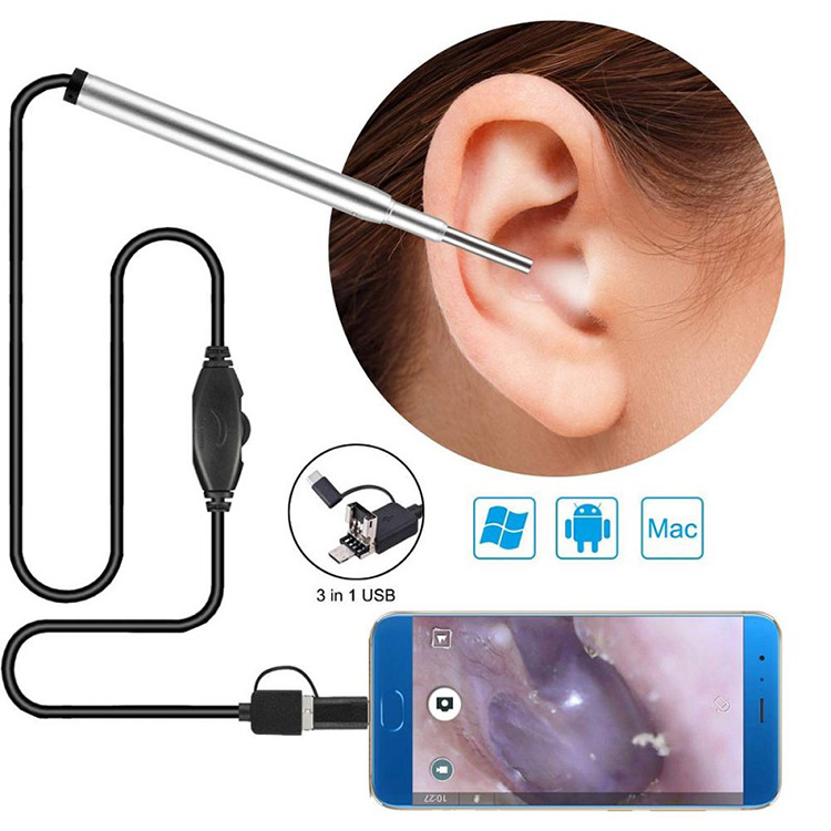 Iṣoogun Endoscope Kamẹra Eti Imu Endoscope Usb Otoscope